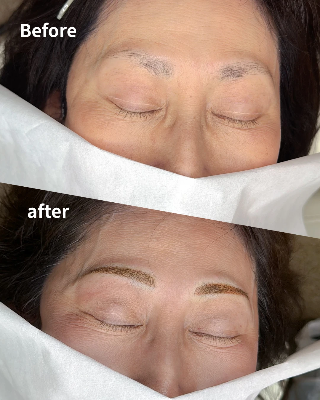 眉アートメイクの症例写真（Before/After）