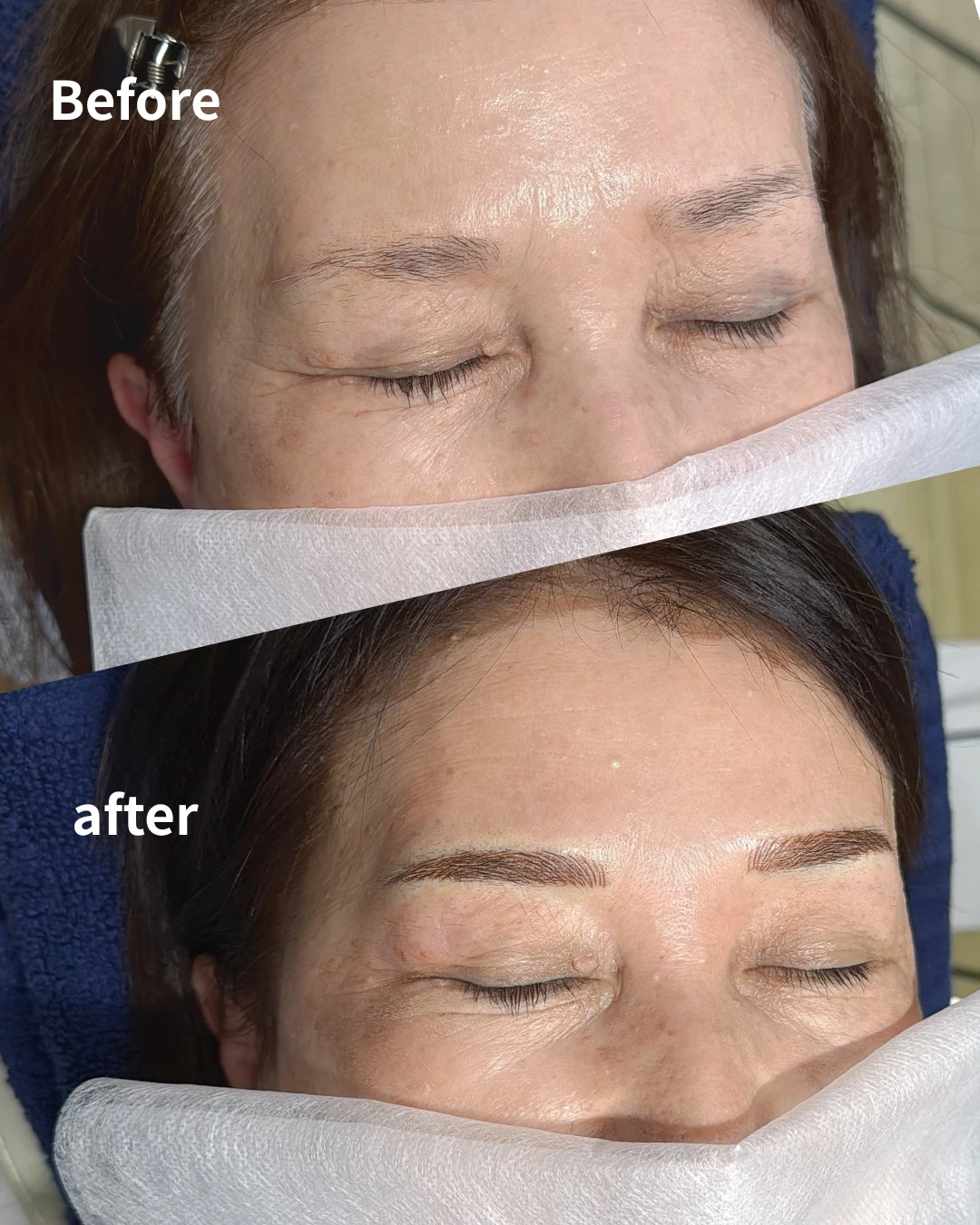 眉アートメイクの症例写真（Before/After）