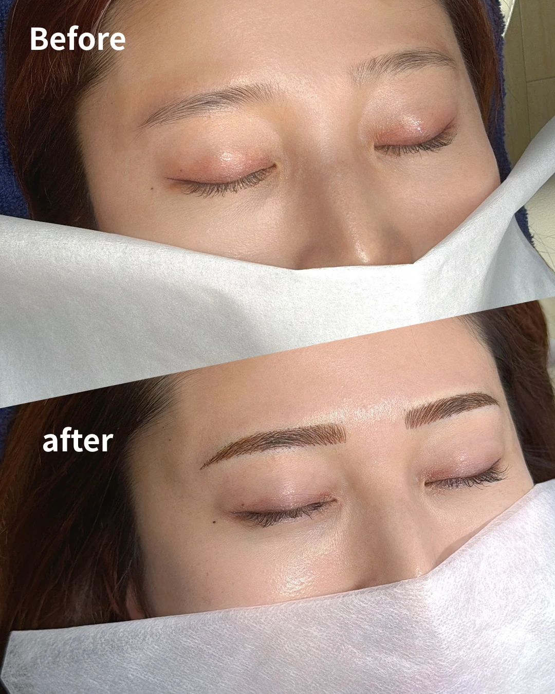 眉アートメイクの症例写真（Before/After）