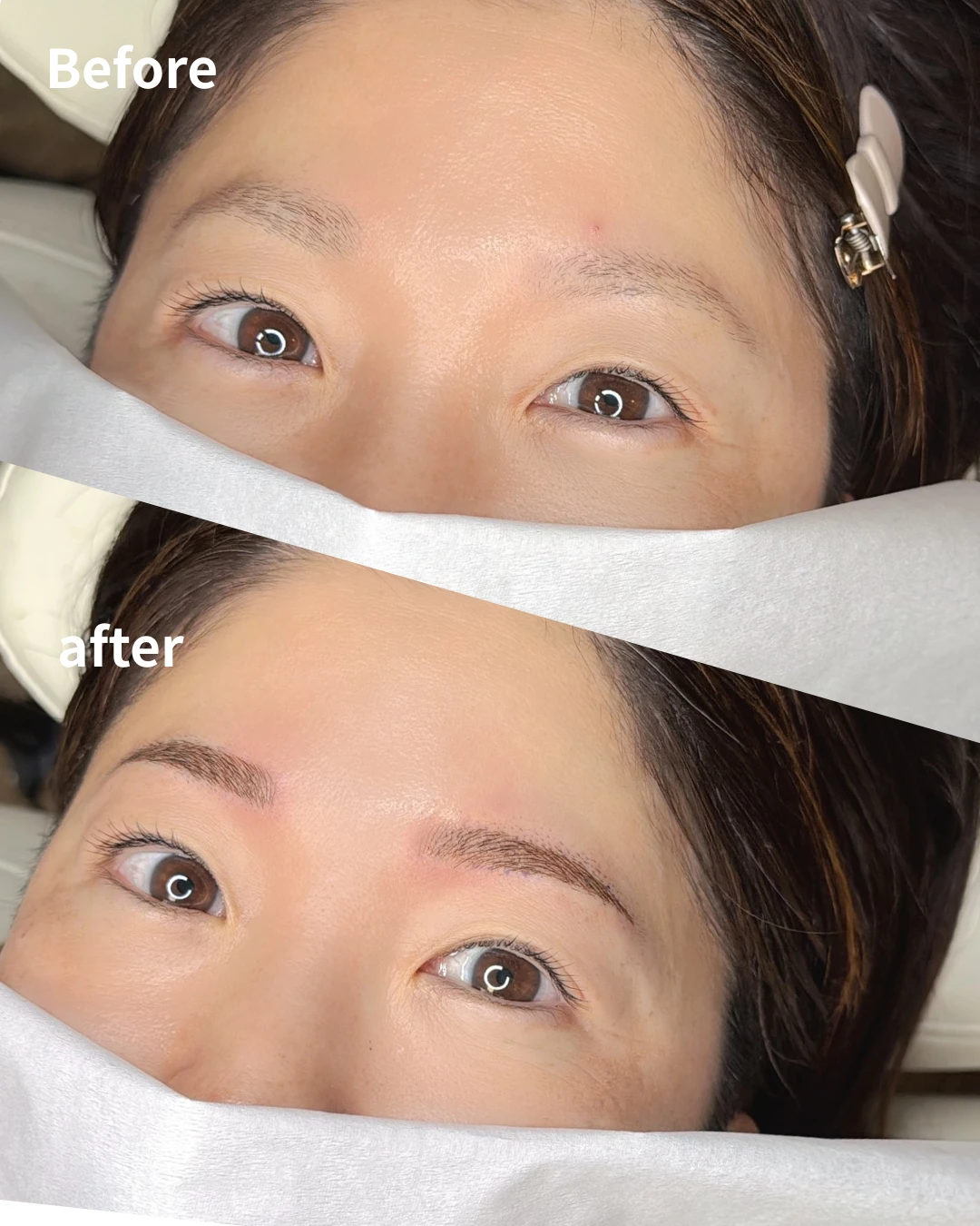 眉アートメイクの症例写真（Before/After）