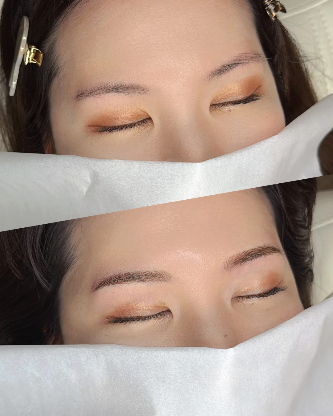 眉アートメイクの症例写真（Before/After）
