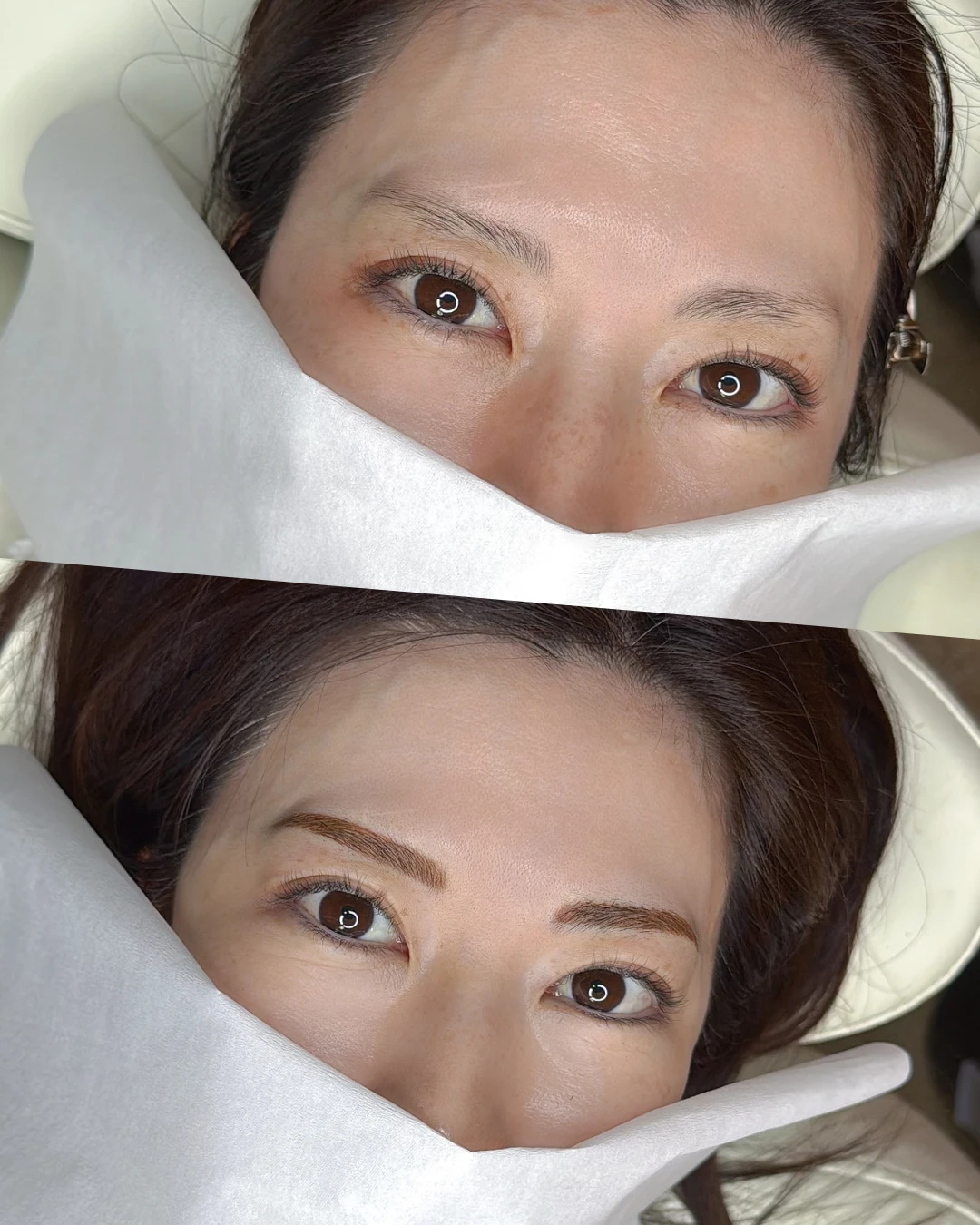 眉アートメイクの症例写真（Before/After）