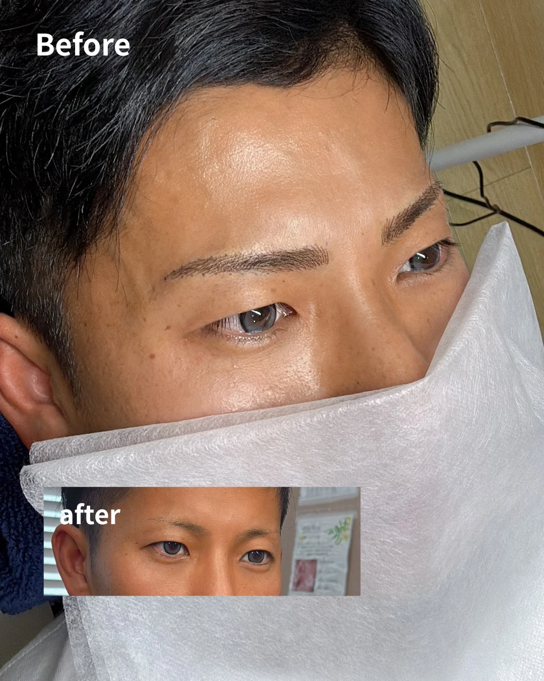 眉アートメイクの症例写真（Before/After）